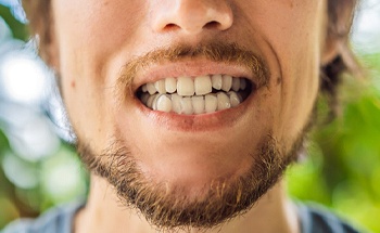 person with bruxism, grinding their teeth