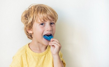 Child putting a customized dental mouthguard for bruxism in their mouth