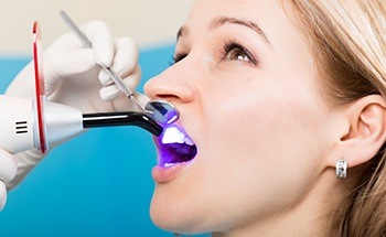 Close up of woman receiving dental bonding on a front tooth