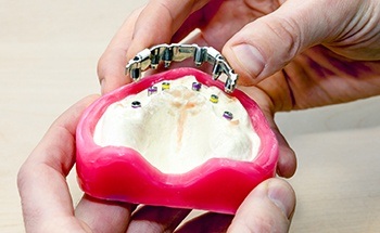 Hand hiding a model of an implant denture