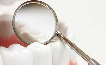 Illustrated dental mirror next to teeth