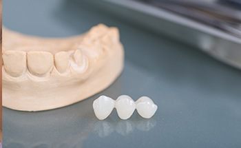 Dental bridge on table next to a model of the mouth