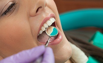 Woman with dental mirror in her mouth