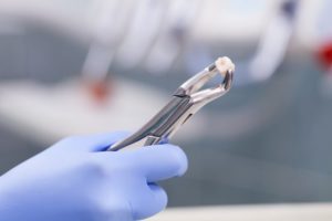 A dentist holding an extracted tooth.