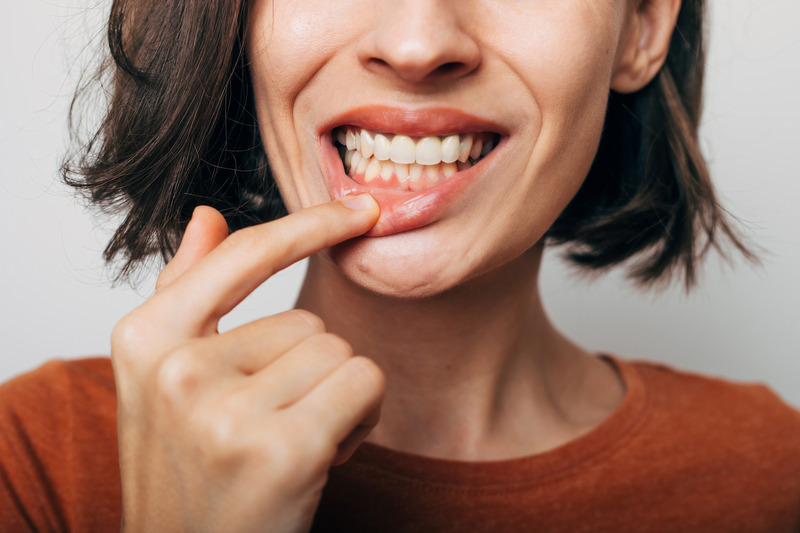 Patient checking their gums